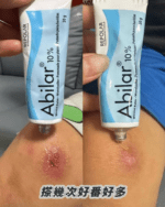 Repolar Pharmaceutical Abilar® Wound Balm 20g - Image 3